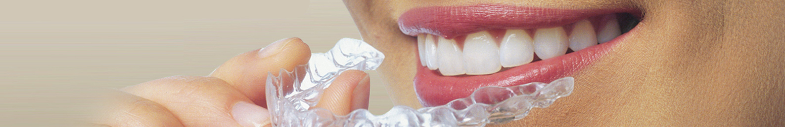 Aligners