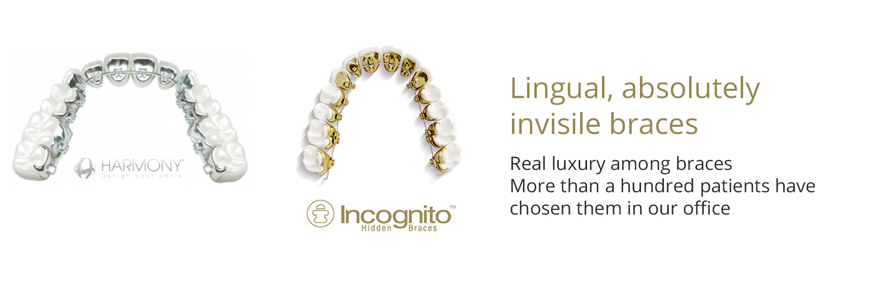 HP lingual, absolutely invisile braces