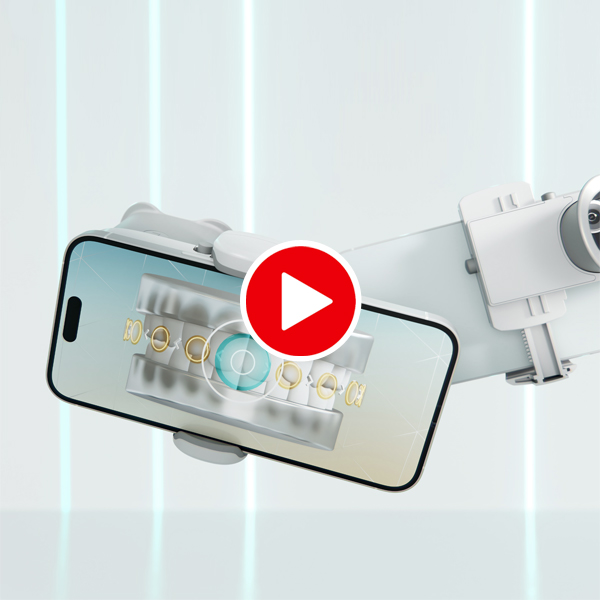 Video - Dental Monitoring