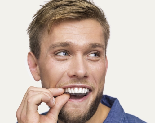 Jak stará je technologie foliových rovnátek?